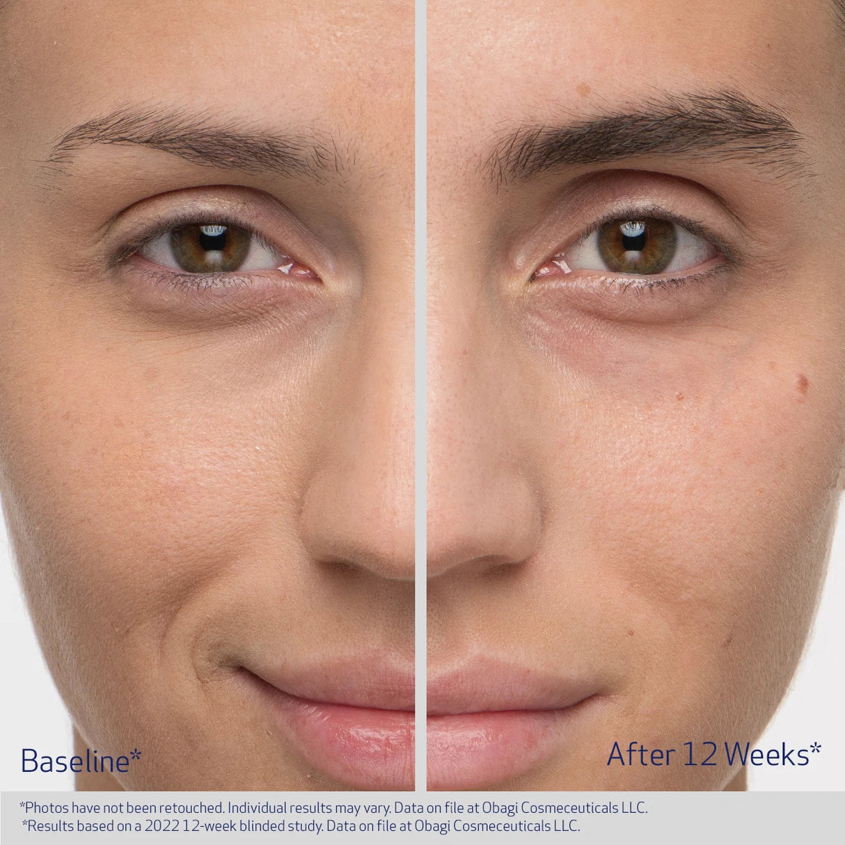 Obagi Nu-Cil Eyebrow Boosting Serum | Eyebrow Serum | 5ml