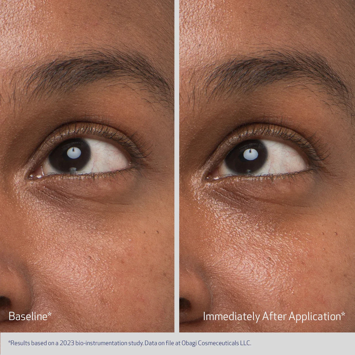 Obagi Daily Hydro-Drops Rejuvenating Eye Gel Cream | Eye Treatment | 15ml