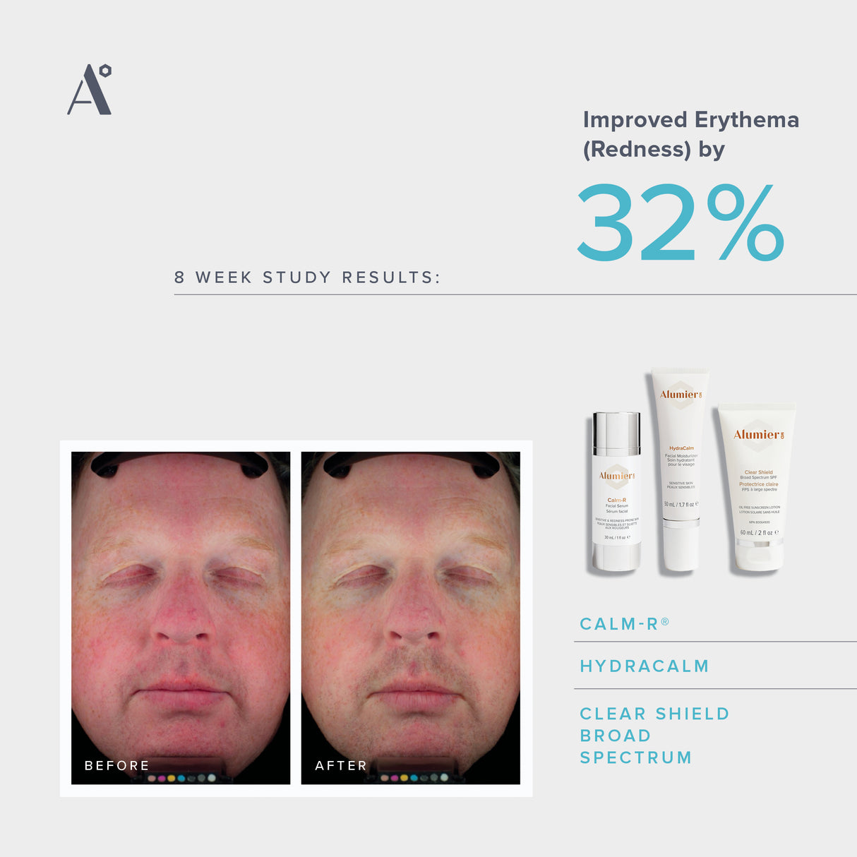 AlumierMD Calm-R® Serum | 30ml-Targeted Serums-Skintique Retail