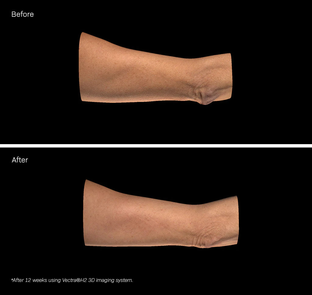 Revision Skincare BodiFirm Body Firming Treatment