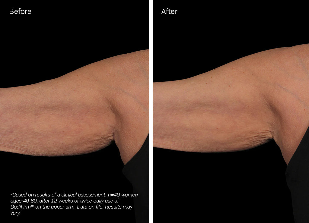 Revision Skincare BodiFirm Body Firming Treatment