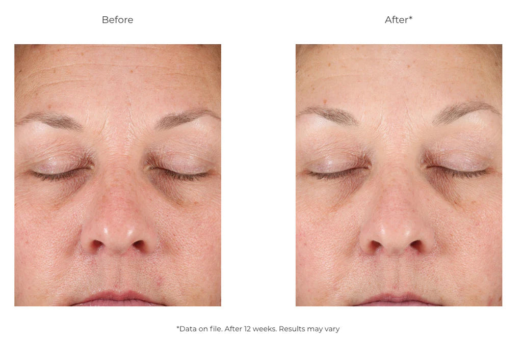 Revision Skincare D·E·J Face Cream®