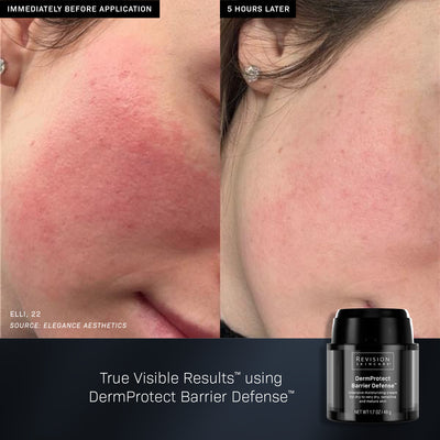 Revision Skincare DermProtect Barrier Defense™