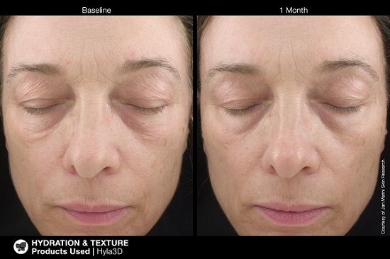 Jan Marini Hyla3D Face Serum-Targetted Serum-Skintique Retail