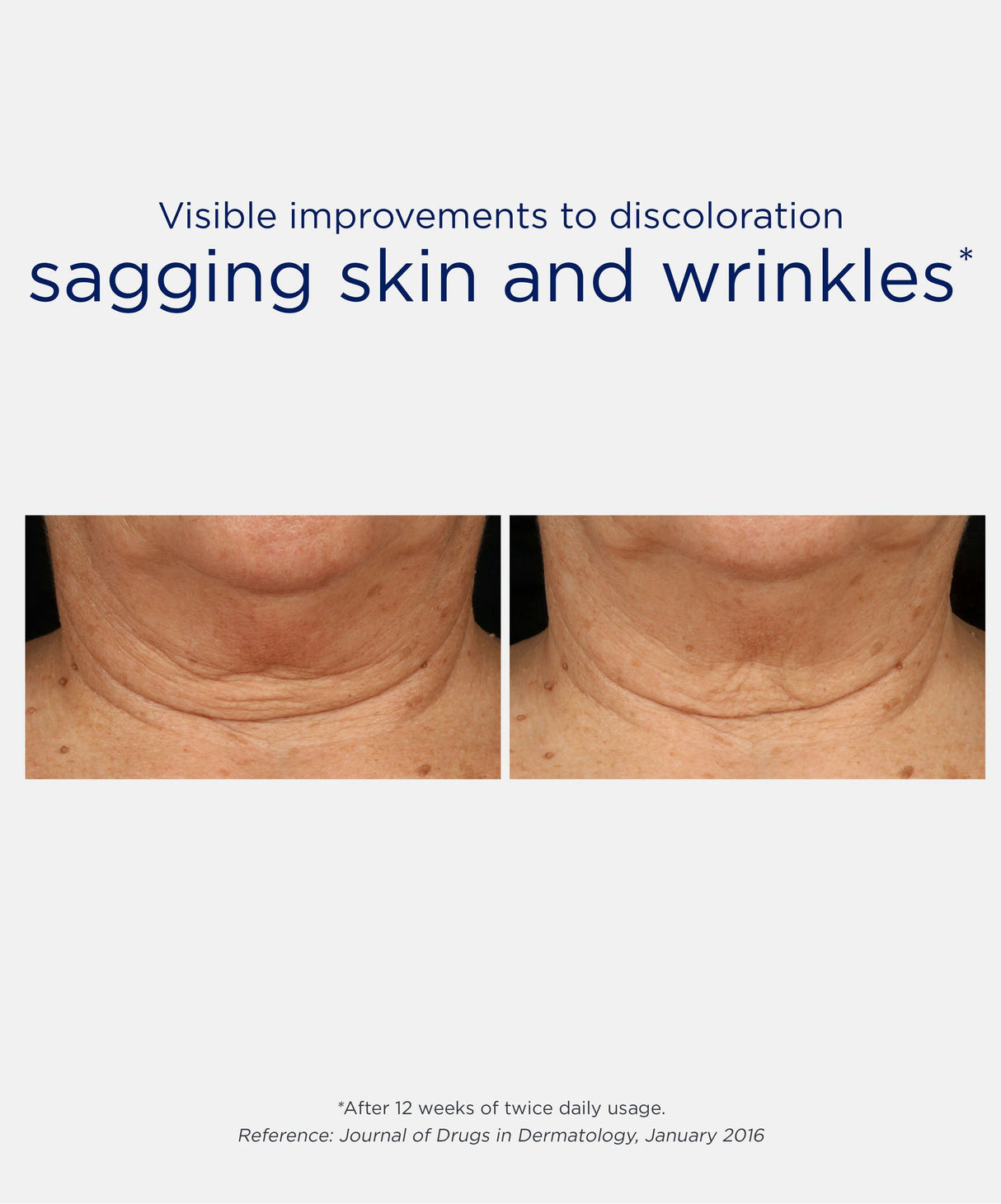 NeoStrata Skin Active Triple Firming Neck Cream | 80g-Targeted Creams-Skintique Retail