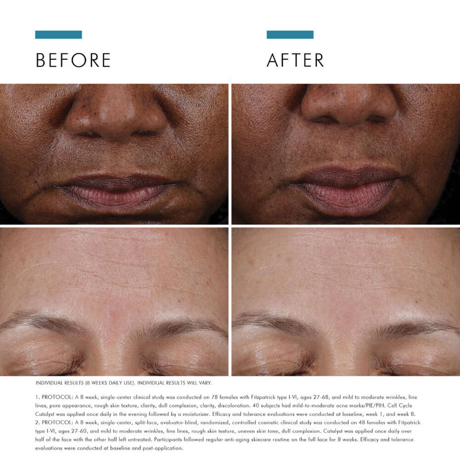 Skinceuticals Cell Cycle Catalyst | 30ml-Targeted Serums-Skintique Retail