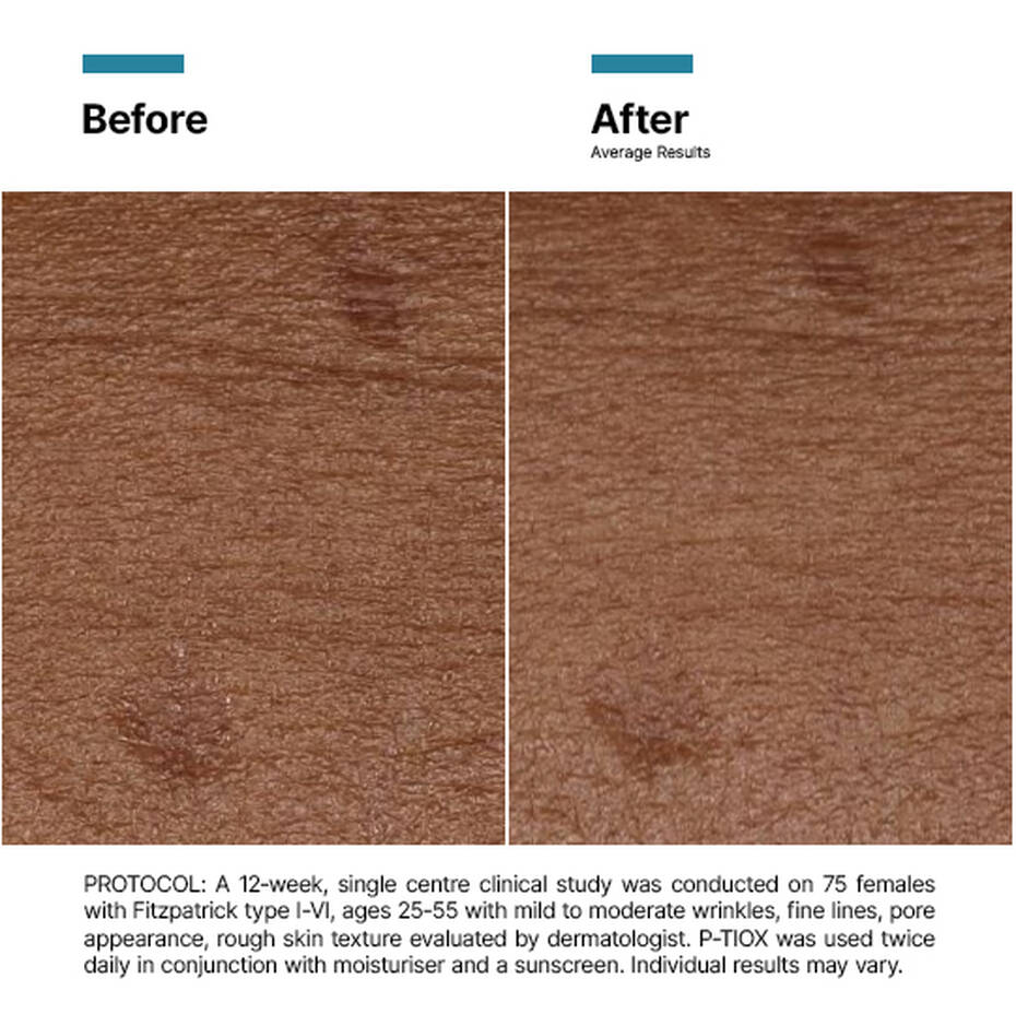 Skinceuticals P-TIOX | 30ml-Targeted Serums-Skintique Retail