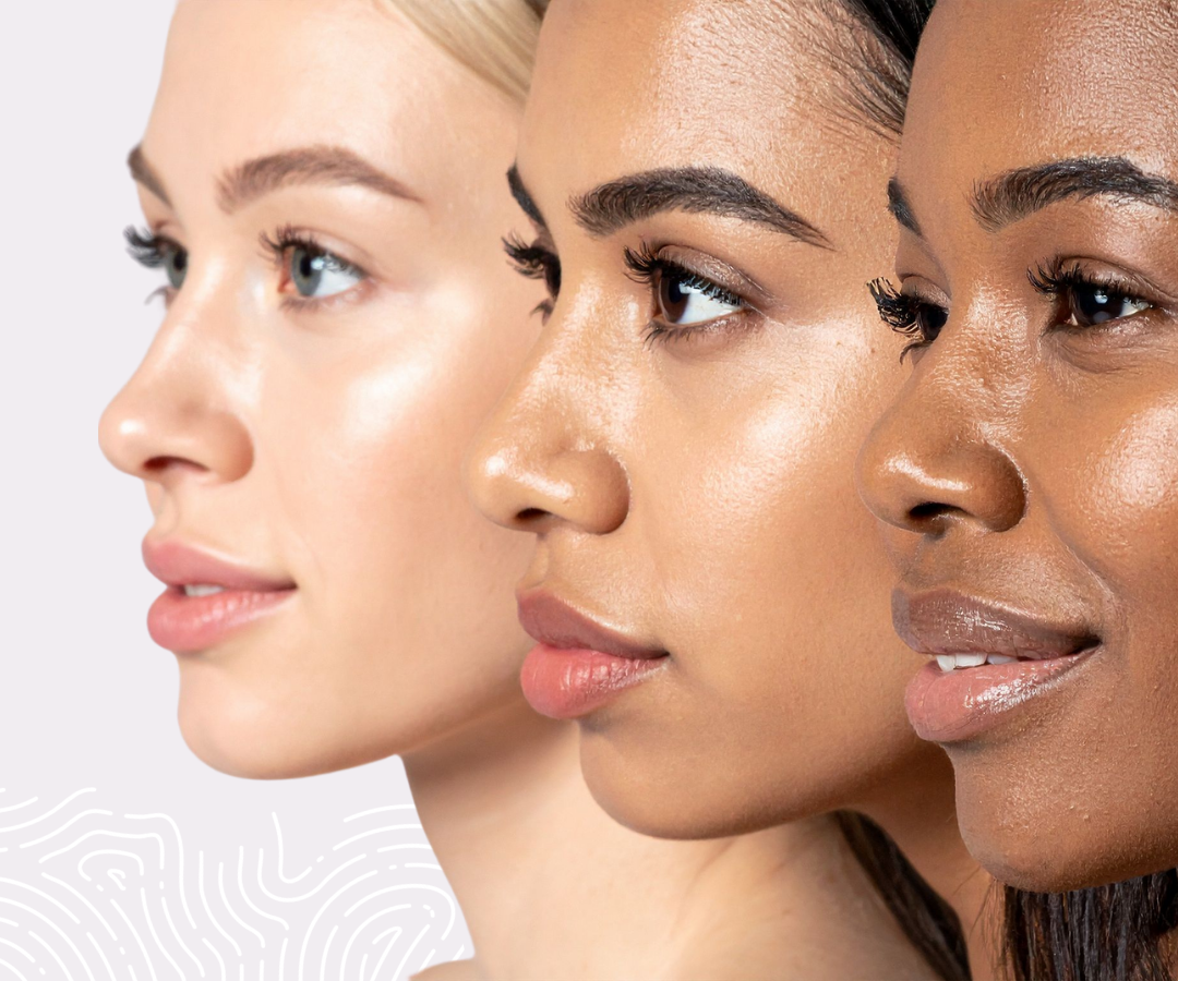 Skin Type vs. Skin Condition: Understanding Your Skin | National Skincare Awareness Month