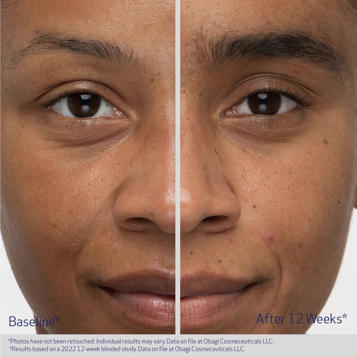 Obagi Nu-Cil Eyebrow Boosting Serum | Eyebrow Serum | 5ml