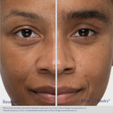 Obagi Nu-Cil Eyebrow Boosting Serum | Eyebrow Serum | 5ml