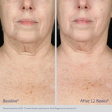 Obagi ELASTIderm Neck & Décolleté Concentrate | Anti-Ageing Serum | 60ml