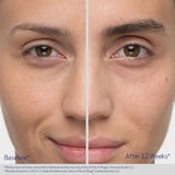 Obagi Nu-Cil Eyebrow Boosting Serum | Eyebrow Serum | 5ml