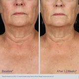 Obagi ELASTIderm Neck & Décolleté Concentrate | Anti-Ageing Serum | 60ml