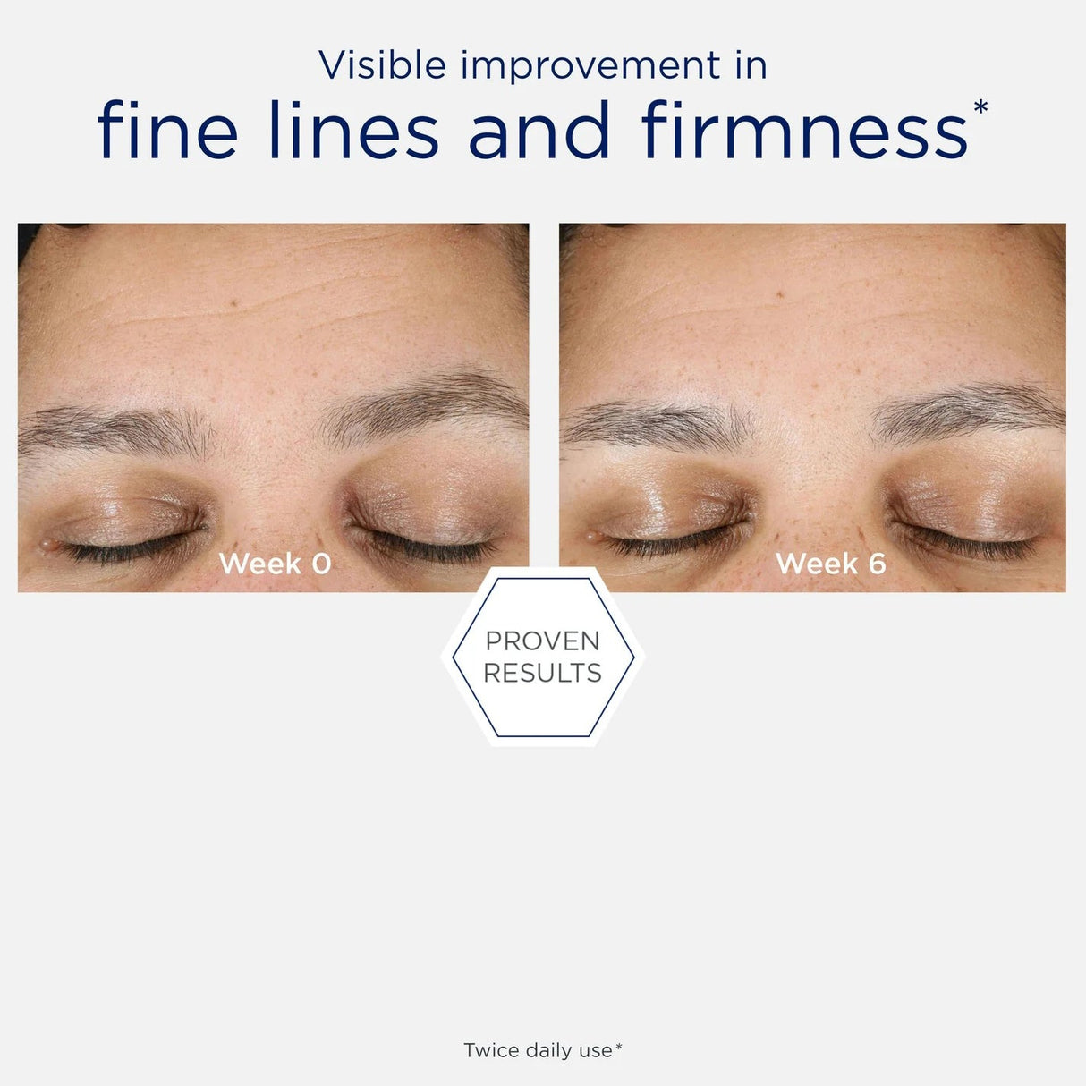 NeoStrata Hyaluronic Luminous Lift | Gel Cream | 50g