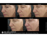 Jan Marini Age Intervention Retinol Plus-Targetted Serum-Skintique Retail