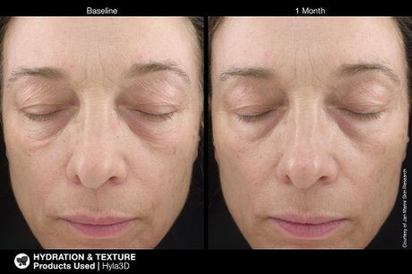 Jan Marini-Jan Marini Hyla3D Face Serum-Targetted Serum-