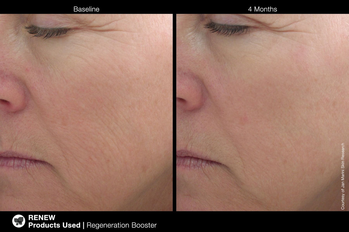 Jan Marini-Jan Marini Regeneration Booster-Serum-