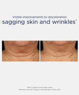 NeoStrata-NeoStrata Skin Active Triple Firming Neck Cream | 80g-Targeted Creams-