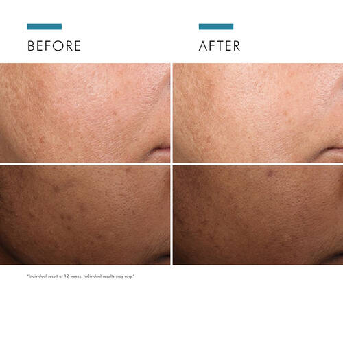 SkinCeuticals-SkinCeuticals Discolouration Defense Serum | 30ml-Serum-
