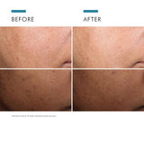 SkinCeuticals-SkinCeuticals Discolouration Defense Serum | 30ml-Serum-
