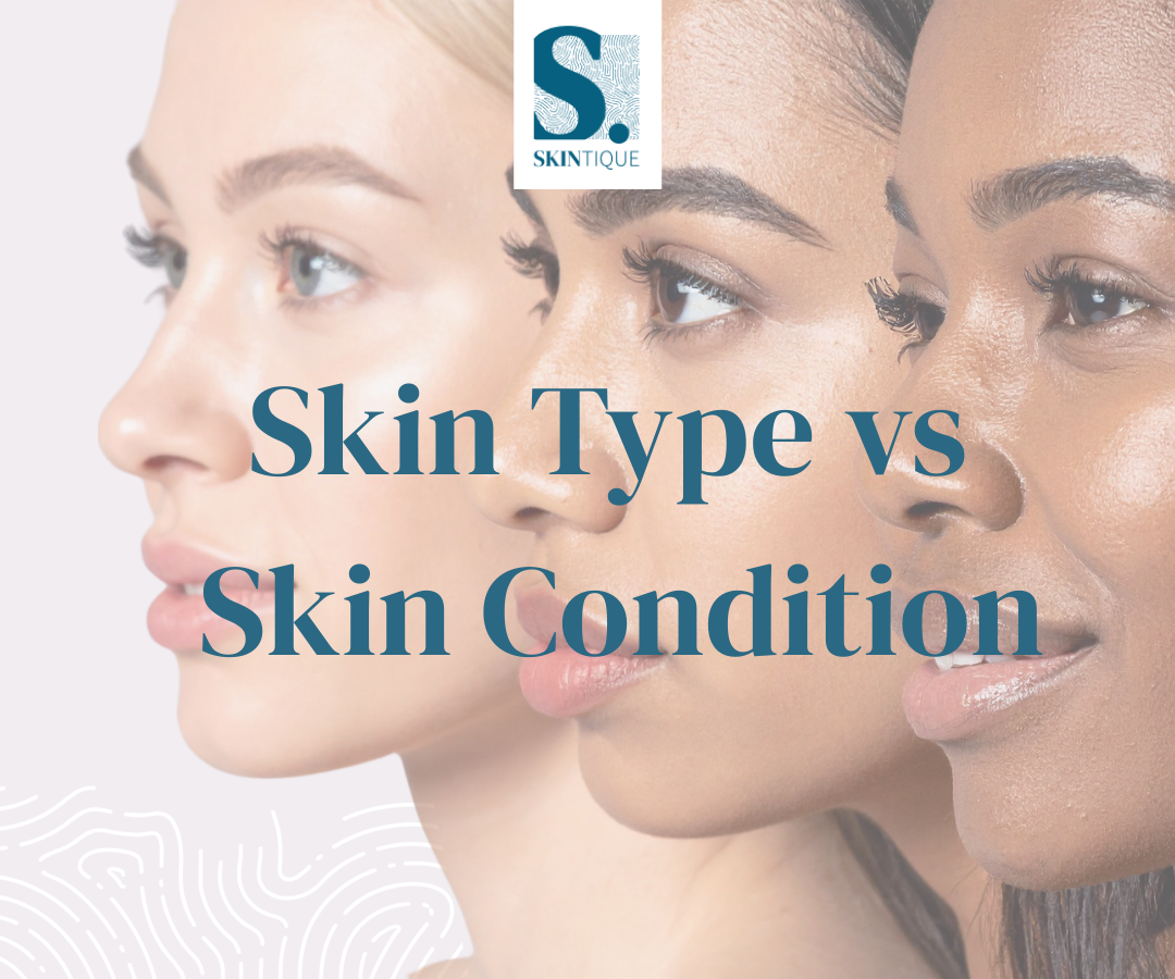 Guide to managing acne