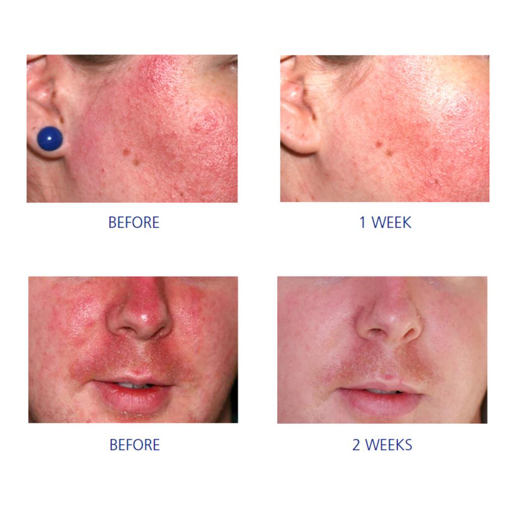 iS Clinical-iS Clinical Pro-Heal Serum Advance + | Vitamin C Serum-Serum-