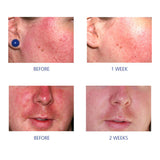 iS Clinical-iS Clinical Pro-Heal Serum Advance + | Vitamin C Serum-Serum-