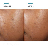 SkinCeuticals - SkinCeuticals Phyto A+ Brightening Treatment 3% Azelaic Acid Moisturiser | 30ml - Skintique - Moisturiser